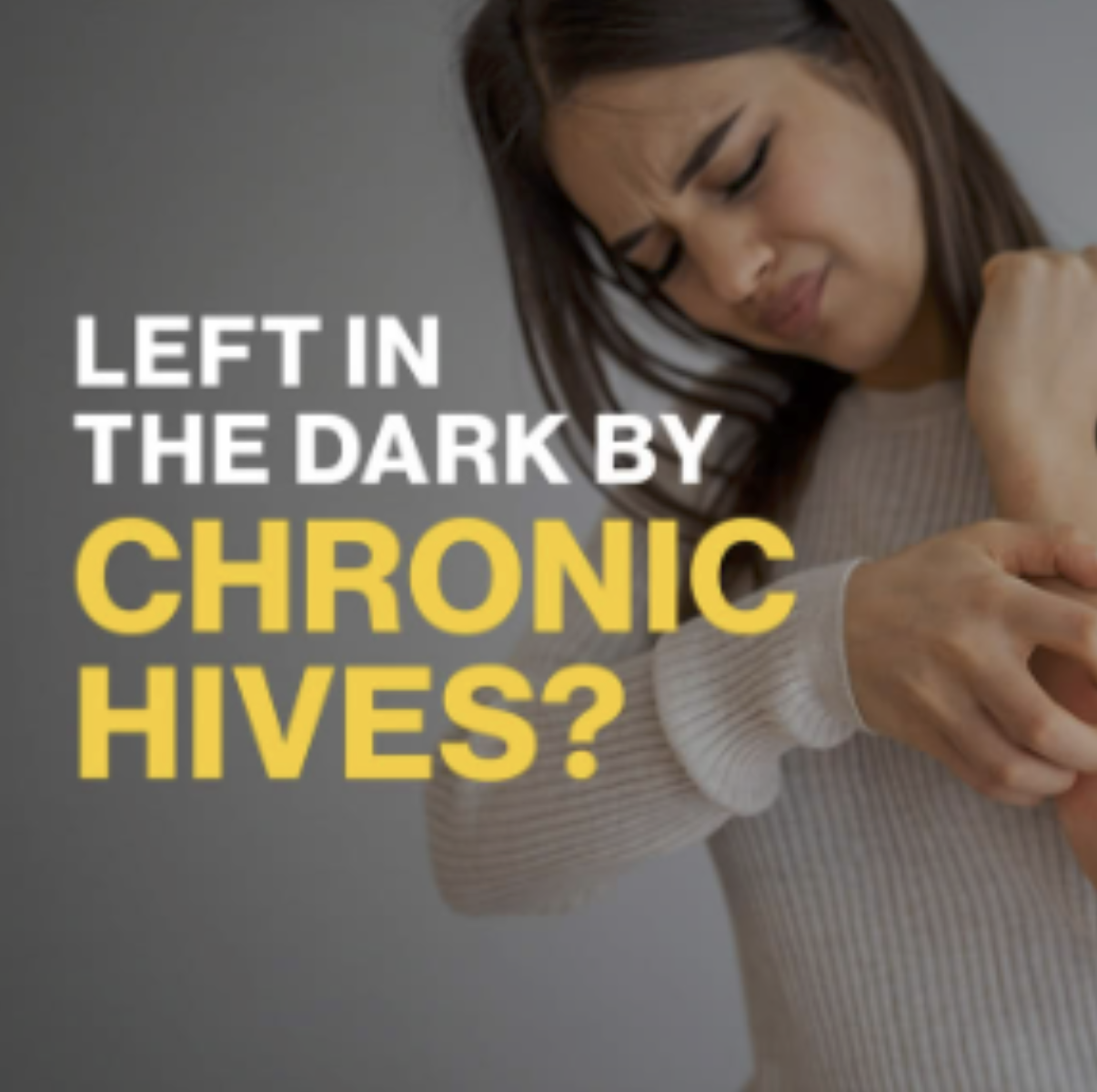 Diagnosed with Chronic Hives
